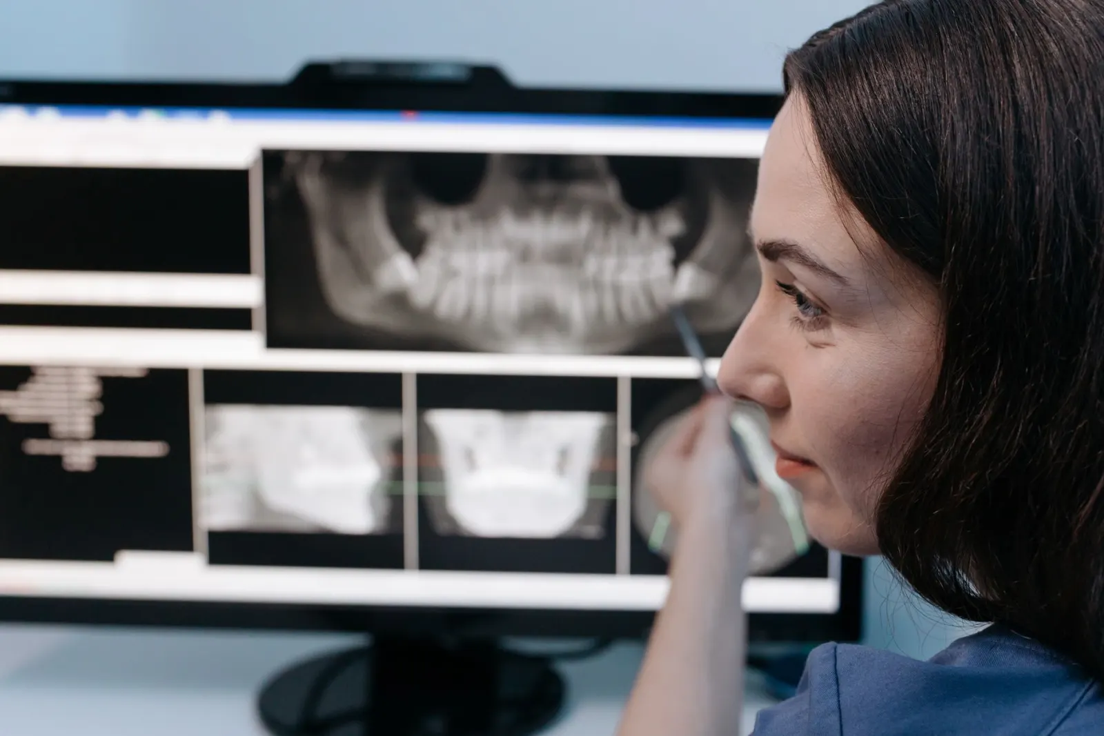 Your Dental Work Failed. What Happens Next?