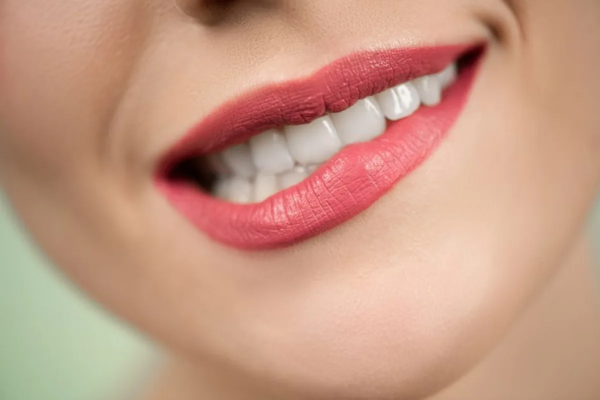 Porcelain Veneers at LAL Dental, Midtown East Manhattan